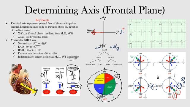 29.Determining Axis (Frontal Plane) смотреть онлайн