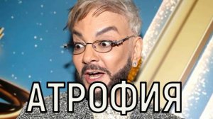 Преждевременное старение. Ухудшающееся состояние Филиппа Киркорова напоминает судьбу Началовой.