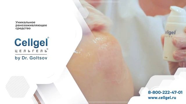 Цельгель в практике косметологов смотреть онлайн