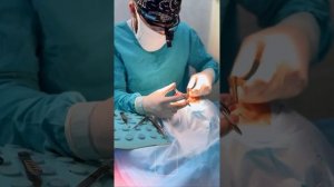 ОПЕРАЦИЯ НА ПЕРЕГОРОДКУ НОСА / ПРОВЕЛИ ПЛАСТИКУ НОСА /