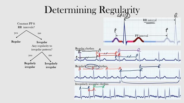 27.Determining Regularity смотреть онлайн