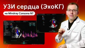 УЗИ сердца. Мастер-класс по эхокардиографии на Mindray Consona N7