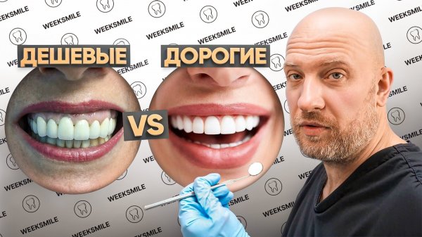 Сравнение дорогих и дешевых виниров! Какие виниры выбрать? Какие лучше стачивают и уход за винирами