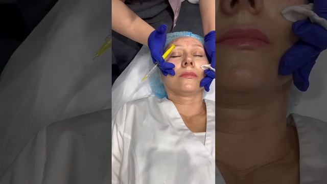 Как колоть Mayster PLLA Booster полимолочная кислота введение