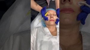 Как колоть Mayster PLLA Booster полимолочная кислота введение