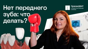 Имплантация передних зубов: все о методах и восстановлении после. | ПрезиДЕНТ💚