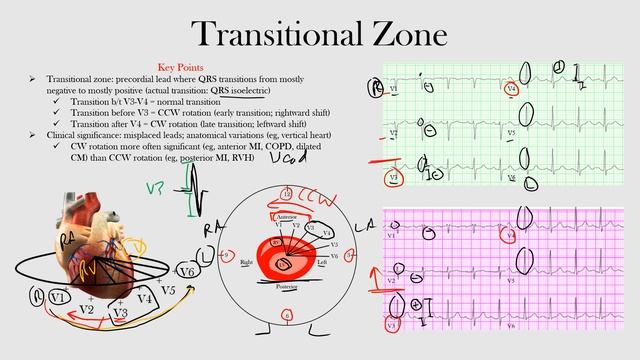 30.Transitional Zone смотреть онлайн