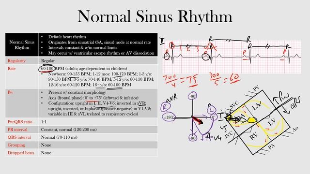 33.Normal Sinus Rhythm смотреть онлайн