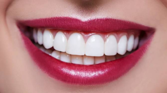 Отбеливание зубов дома смотреть онлайн