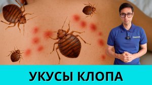 Укусы клопов: как выглядят укусы постельных клопов на коже человека?