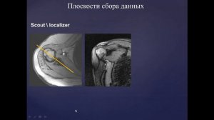 Методика исследования и МР анатомия плечевого сустава Учеваткин АА Трофименко И А