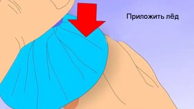 Травматизм смотреть онлайн