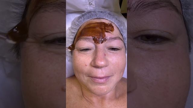 Уход за лицом после похудения на 60 кг.Массаж ГУАША