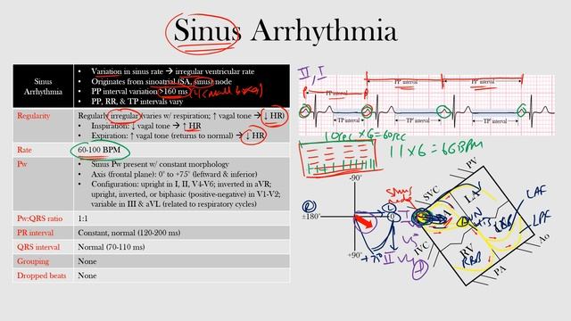 34.Sinus Arrhythmia смотреть онлайн