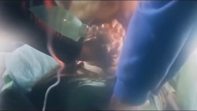 Если бы скорая была ПРОЗРАЧНОЙ! - мощная социалка, социальная реклама смотреть онлайн