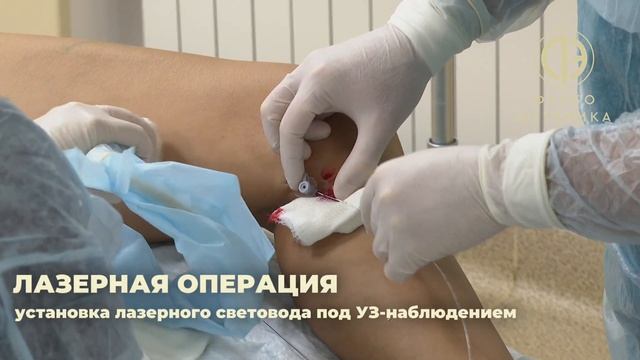 ЛАЗЕРНАЯ ОПЕРАЦИЯ (ЭВЛК) - удаление вен лазером, лечени