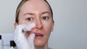 Как убрать носогубные морщины? Эффективный массаж дом