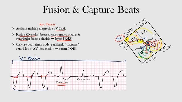 57.Fusion & Capture Beats смотреть онлайн
