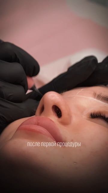 МИФ ИЛИ РЕАЛЬНОСТЬ? Можно ли достичь идеального результата после первой процедуры?