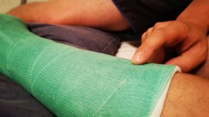 Полимерный бинт, пластиковый гипс, скоч каст, перелом ?