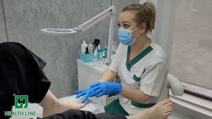 Установка титановой нити. Лечение вросшего ногтя