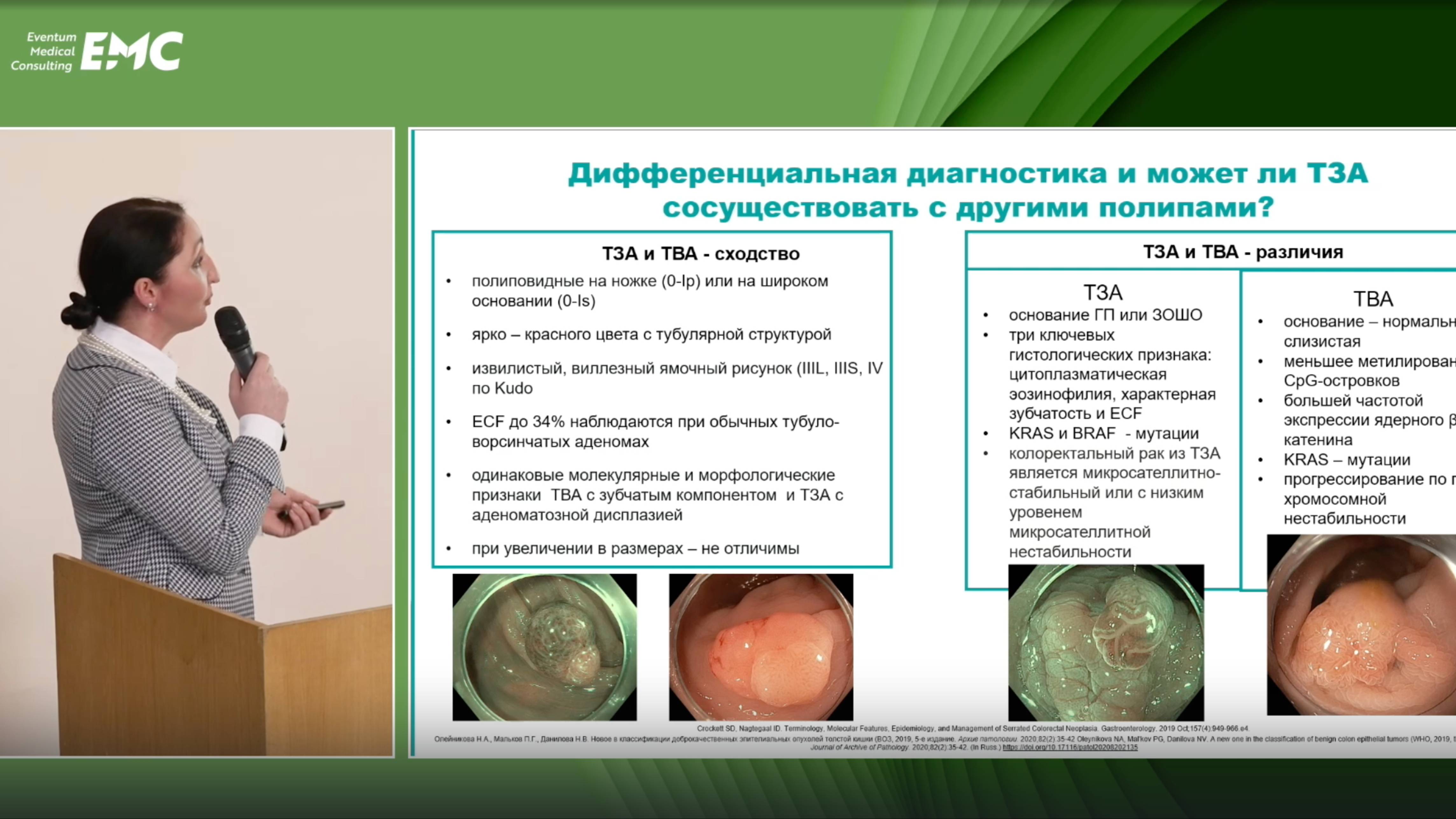 3. Николайчук ТВ, Агейкина НВ Традиционная зубчатая аденома - больше зубчатая? или больше аденома?