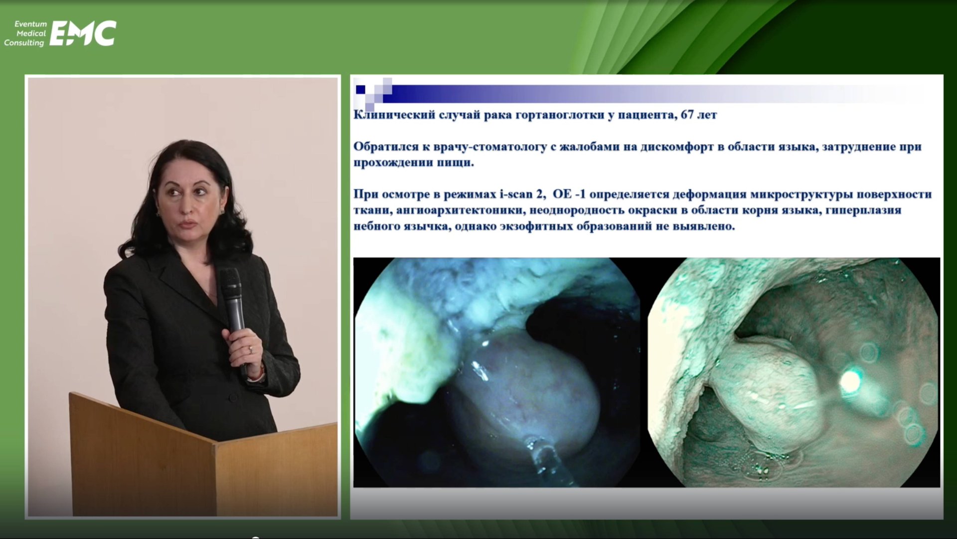 5. Химина И.Н. Трудности диагностики злокачественных новообразований гортаноглотки, желудка.