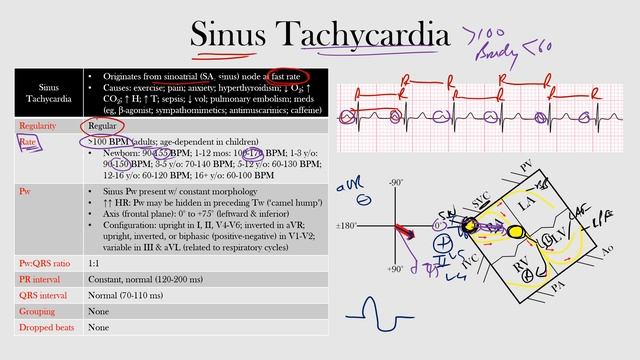 36.Sinus Tachycardia смотреть онлайн