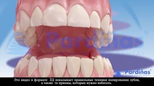 Чистка зубов © - Dentalk!