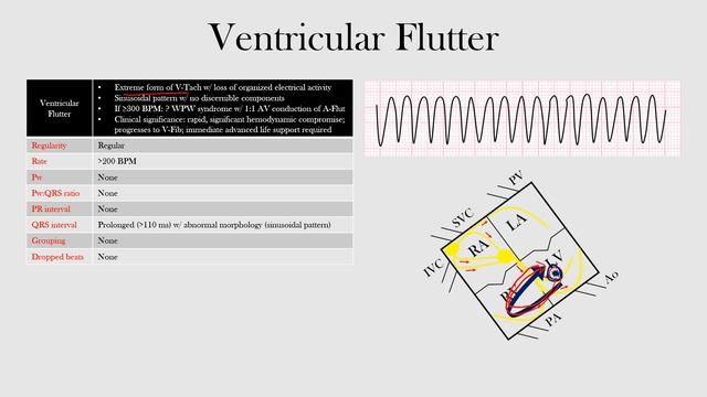 62.Ventricular Flutter смотреть онлайн