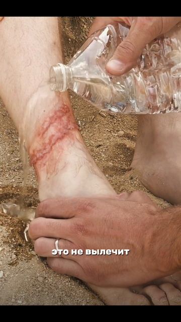 🪼Как спастись от укуса медузы на отдыхе? смотреть онлайн