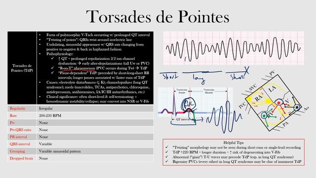 61.Torsades de Pointes смотреть онлайн