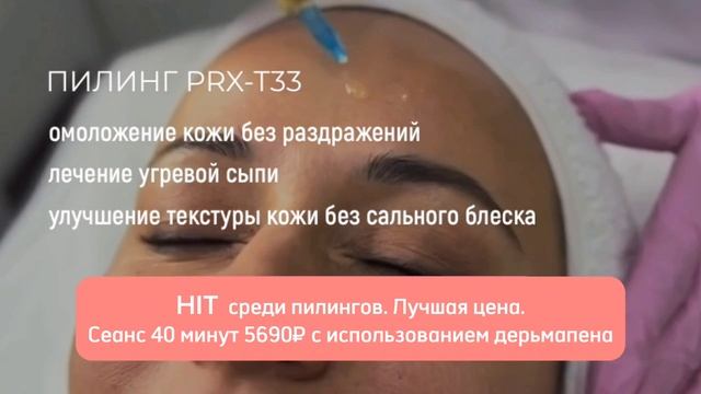 пилинг смотреть онлайн