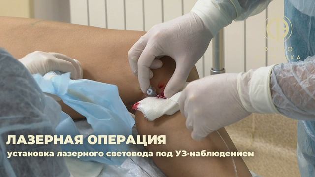 Лазерное лечение смотреть онлайн