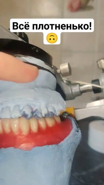 Полный съёмный Протез на нижнюю челюсть #безнёбасъёмн смотреть онлайн