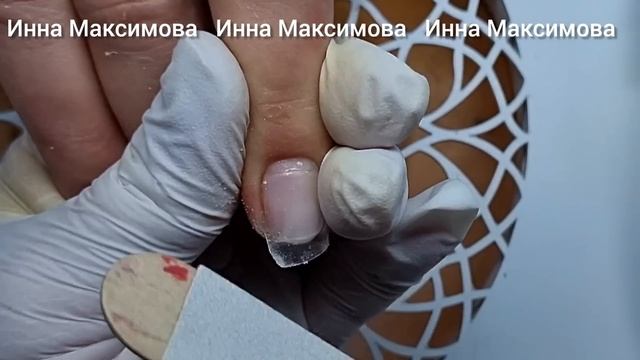 ВОСПАЛЕНИЕ под ОНИХОЛИЗИСОМ