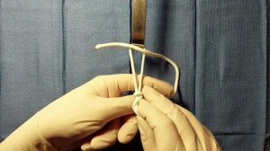 Петля Редера (laparoscopic Roader's knot)
