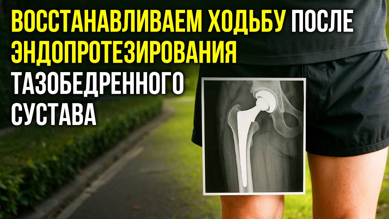 Восстанавливаем ходьбу после эндопротезирования тазобедренного сустава смотреть онлайн