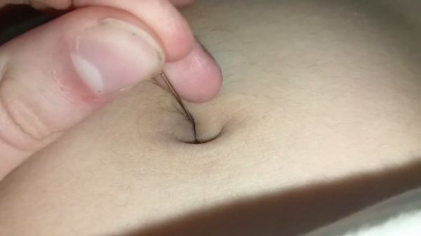 Navel torture. A needle in the navel. Игла в пупке. Belly button torture [Navel pulse exc