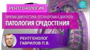 Рентгенолог Гаврилов П.В.: Лучевая диагностика: от синдрома к диагнозу. Патология средостения