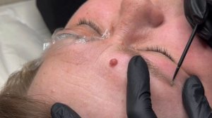 Как удалять перманентный макияж кислотным ремувером?