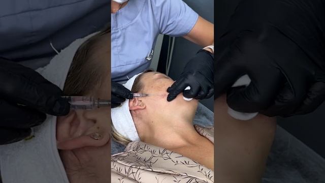 Eldermafill. Зона вокруг глаз. DMAE, HTL-T, Lipo Eyes, Eye Peel.