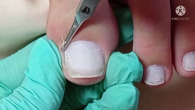 #педикюр_ без обработки стоп_##видео-потеряшка((