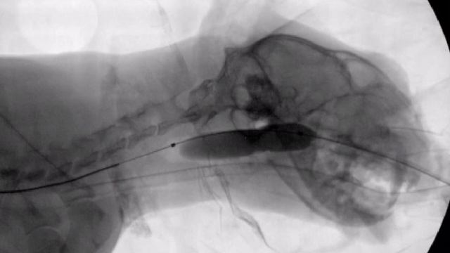 Стеноз носоглотки у кота со стертором, баллонная дила?