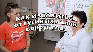 Как не допустить гусиных лапок на лице и отечности глаз!