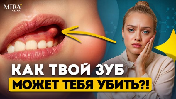 Не лечишь зуб — готовься к гною, боли и удалению! Зубной флюс (абсцесс)