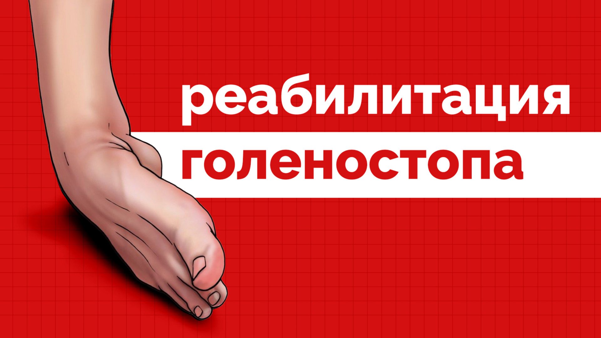 Подворот голеностопа - полная программа реабилитации