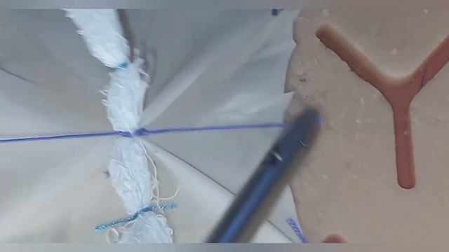 Способ лапароскопического ушивания прободной язвы же