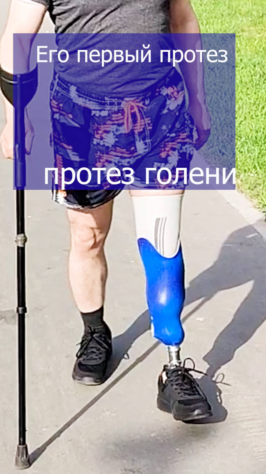 Первые шаги на протезе голени смотреть онлайн