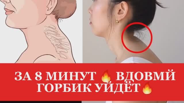 Как убрать ВДОВИЙ ГОРБ за 8 МИНУТ 🔥в день ДОМА? / ВОЛШЕБНЫЕ упражнения от ХОЛКИ на ШЕЕ!#спорт смотреть онлайн